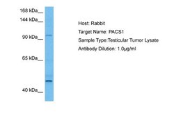 PACS1 Rabbit anti-Human, Polyclonal, Novus Biologicals 0.1 mL | Buy Online | Novus Biologicals | Fisher Scientific